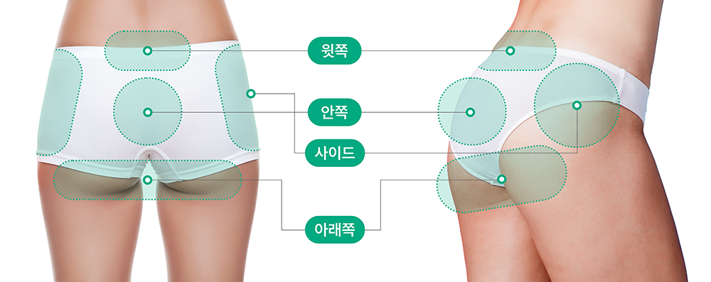 윗쪽, 안쪽, 사이드, 아래쪽